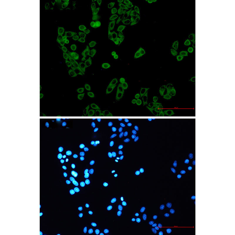 Anti-RENT1 Rabbit Monoclonal Antibody