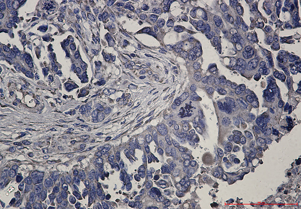 Anti-RENT1 Rabbit Monoclonal Antibody