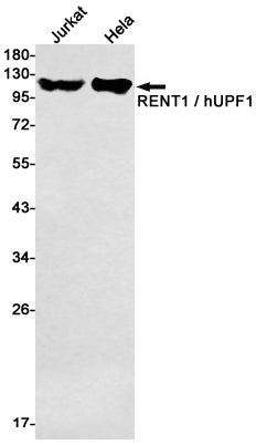 Anti-RENT1 Rabbit Monoclonal Antibody