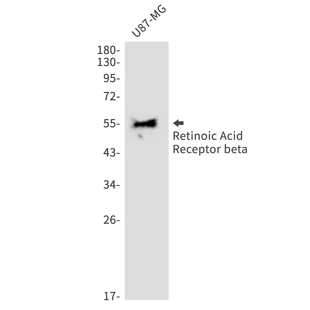 Anti-Retinoic Acid Receptor beta Rabbit Monoclonal Antibody