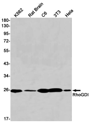 Anti-RhoGDI Rabbit Monoclonal Antibody