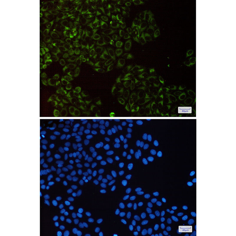 Anti-Complex III Subunit 5 Rabbit Monoclonal Antibody