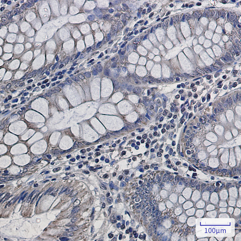 Anti-Complex III Subunit 5 Rabbit Monoclonal Antibody