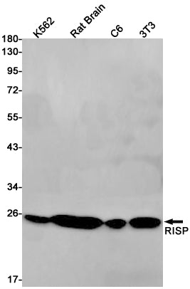 Anti-Complex III Subunit 5 Rabbit Monoclonal Antibody