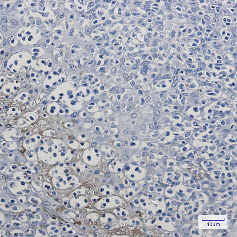 Anti-RKIP Rabbit Monoclonal Antibody