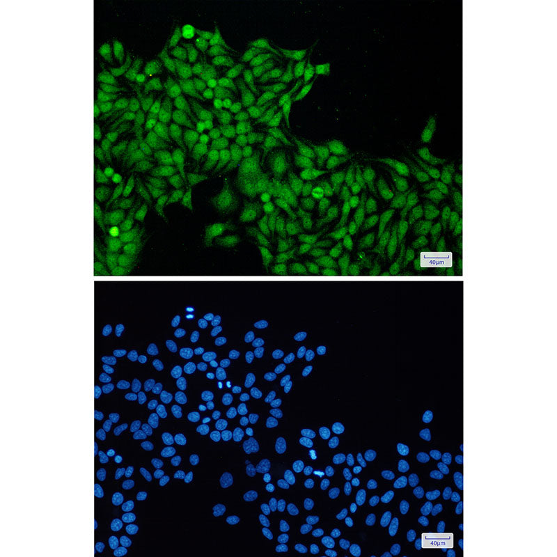 Anti-RBX1 Rabbit Monoclonal Antibody