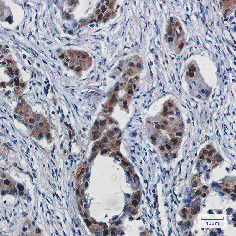 Anti-RBX1 Rabbit Monoclonal Antibody