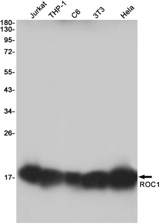 Anti-RBX1 Rabbit Monoclonal Antibody