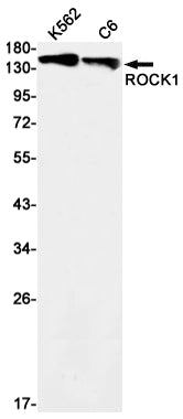 Anti-ROCK1 Rabbit Monoclonal Antibody