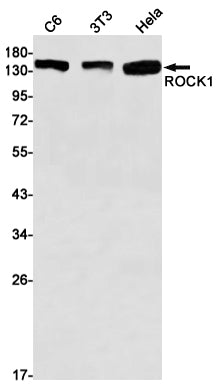 Anti-ROCK1 Rabbit Monoclonal Antibody