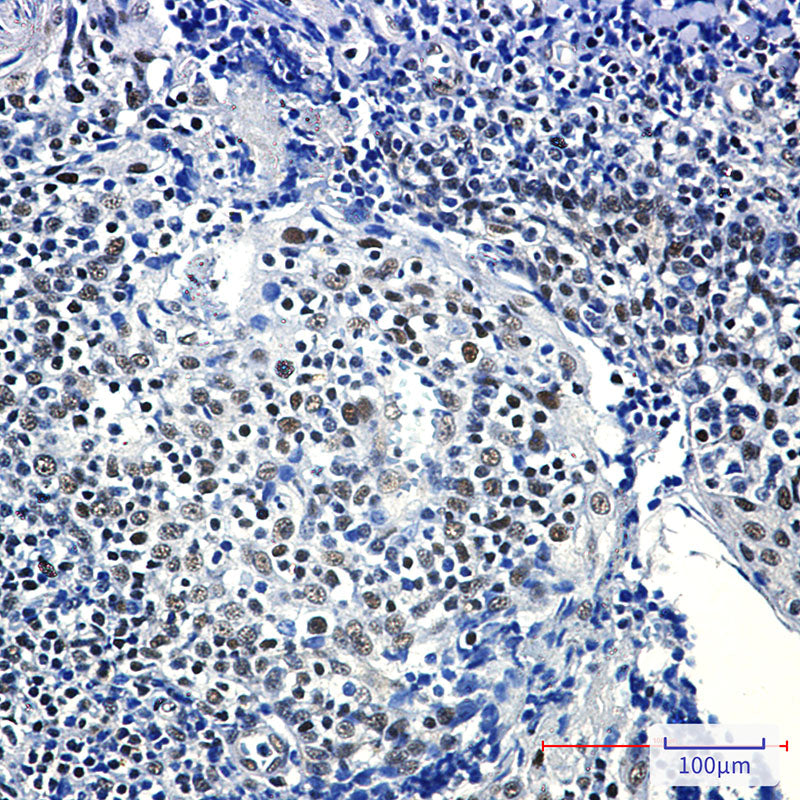Anti-RPA32 Rabbit Monoclonal Antibody