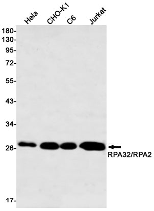 Anti-RPA32 Rabbit Monoclonal Antibody