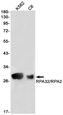Anti-RPA32 Rabbit Monoclonal Antibody