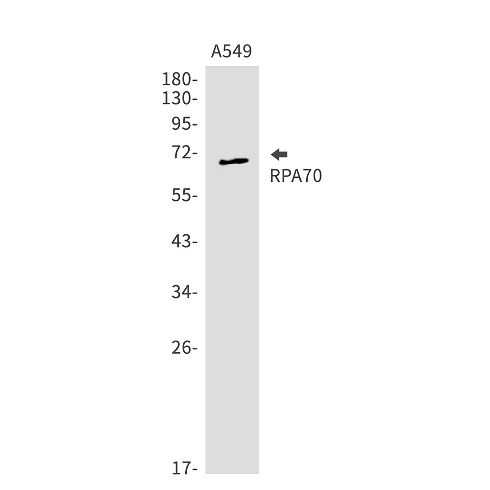 Anti-RPA70 Rabbit Monoclonal Antibody
