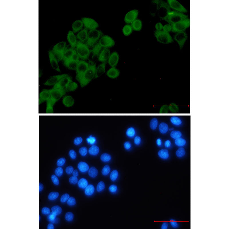 Anti-RRM1 Rabbit Monoclonal Antibody
