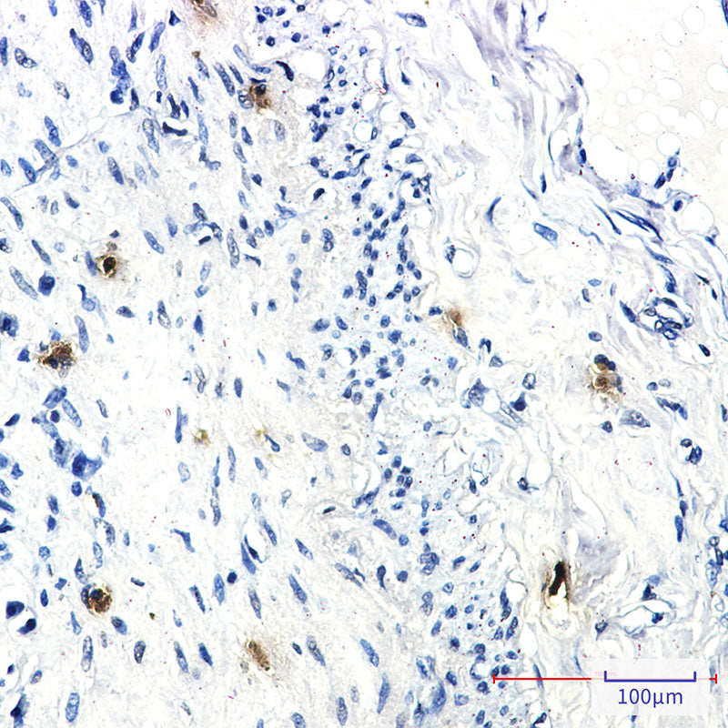 Anti-RRM1 Rabbit Monoclonal Antibody