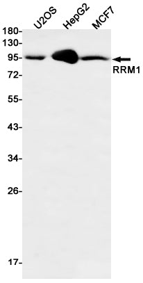 Anti-RRM1 Rabbit Monoclonal Antibody