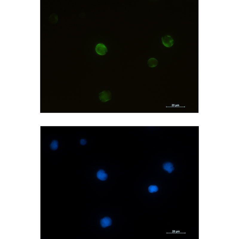 Anti-RRM2 Rabbit Monoclonal Antibody