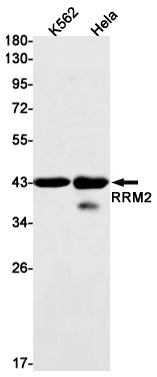 Anti-RRM2 Rabbit Monoclonal Antibody