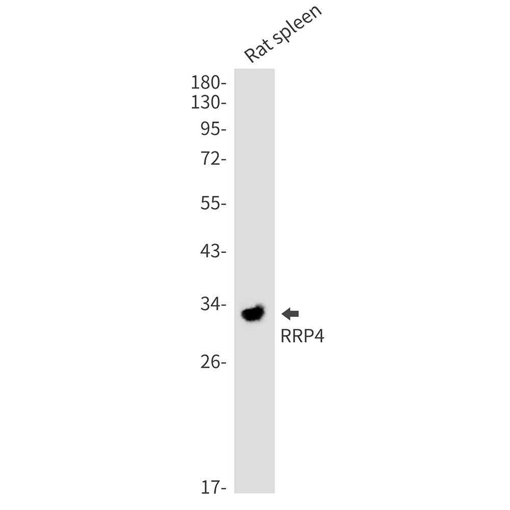 Anti-RRP4 Rabbit Monoclonal Antibody