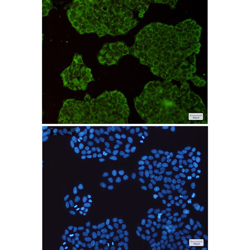 Anti-Exocyst Complex Component 3 Rabbit Monoclonal Antibody