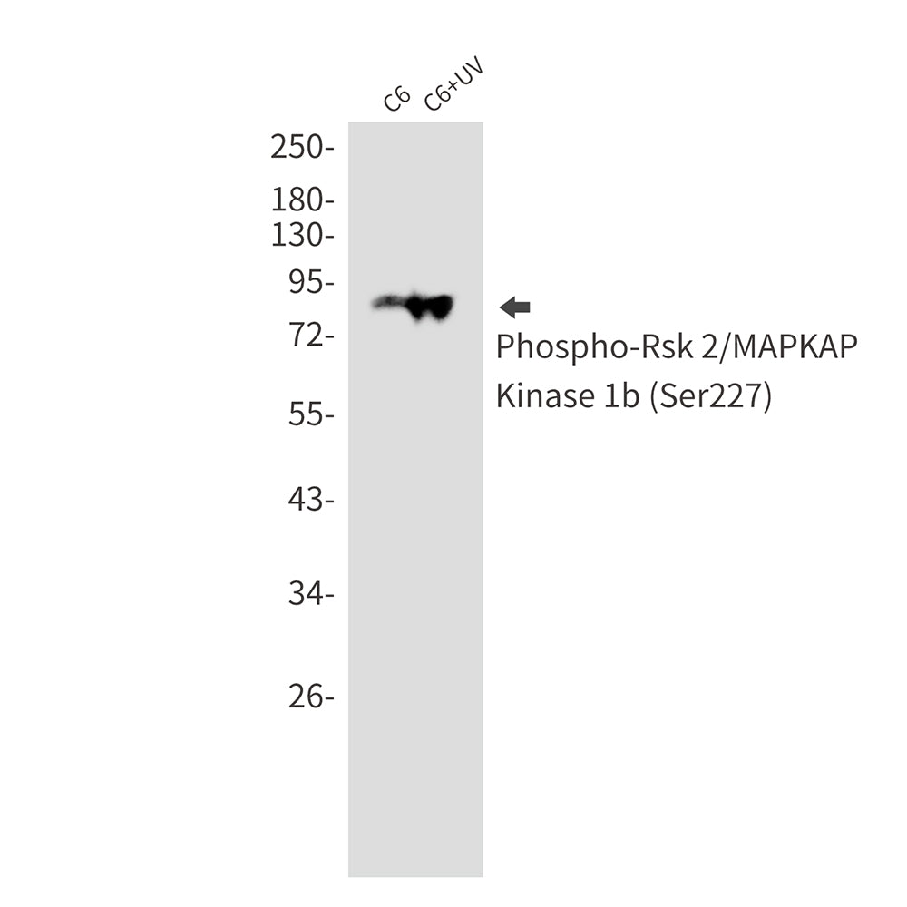 Anti-Phospho-RSK2 (Ser227) Rabbit Monoclonal Antibody