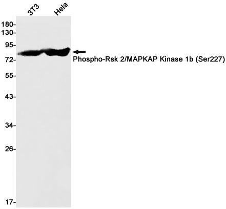Anti-Phospho-RSK2 (Ser227) Rabbit Monoclonal Antibody