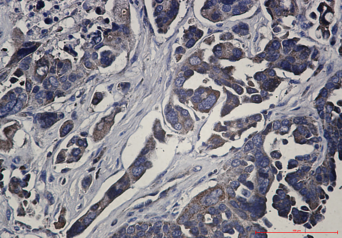 Anti-RSK1 p90 Rabbit Monoclonal Antibody
