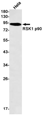 Anti-RSK1 p90 Rabbit Monoclonal Antibody