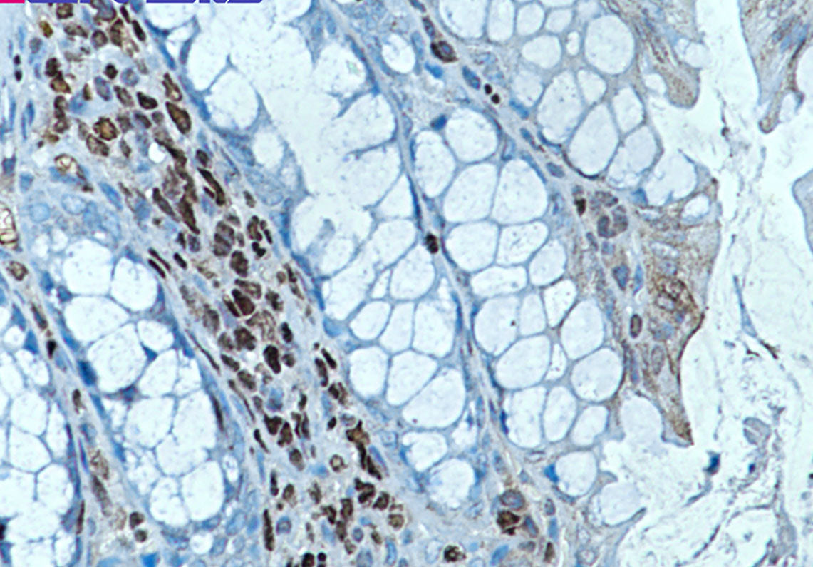 Anti-RUNX Rabbit Monoclonal Antibody