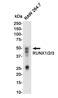 Anti-RUNX Rabbit Monoclonal Antibody