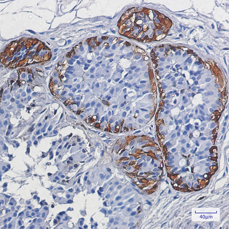 Anti-S100B Rabbit Monoclonal Antibody