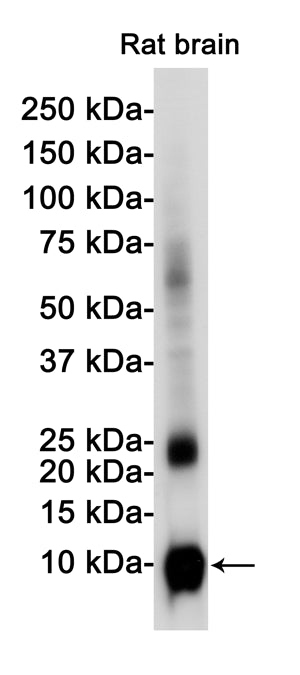 Anti-S100B Rabbit Monoclonal Antibody