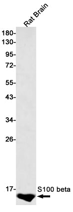 Anti-S100B Rabbit Monoclonal Antibody