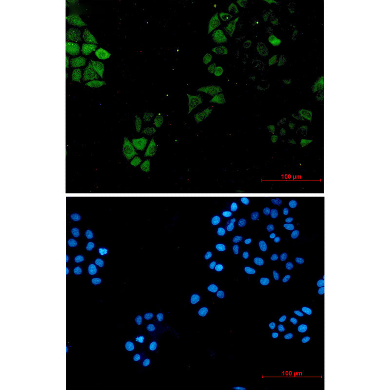 Anti-S100A4 Rabbit Monoclonal Antibody