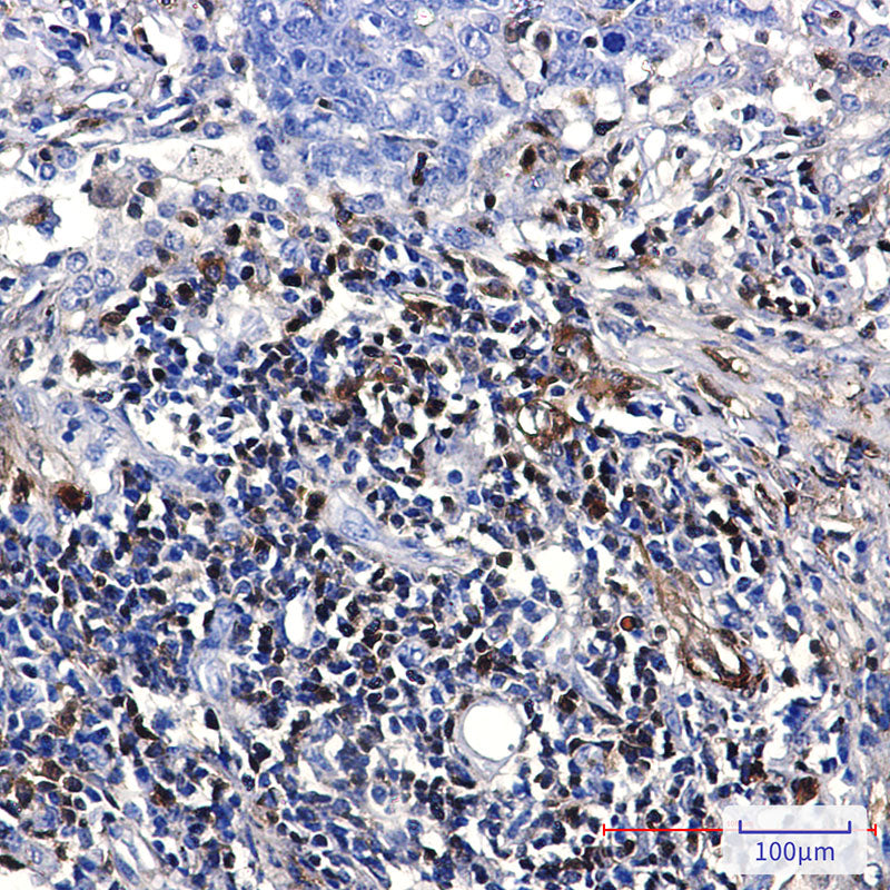Anti-S100A4 Rabbit Monoclonal Antibody