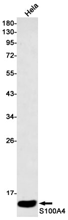Anti-S100A4 Rabbit Monoclonal Antibody