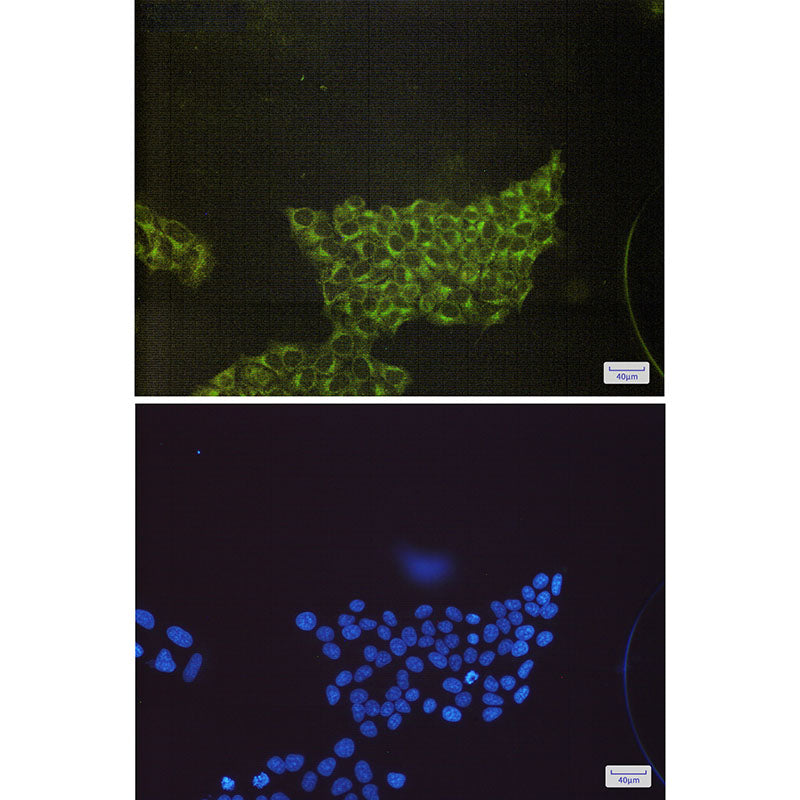 Anti-S6K1 Rabbit Monoclonal Antibody