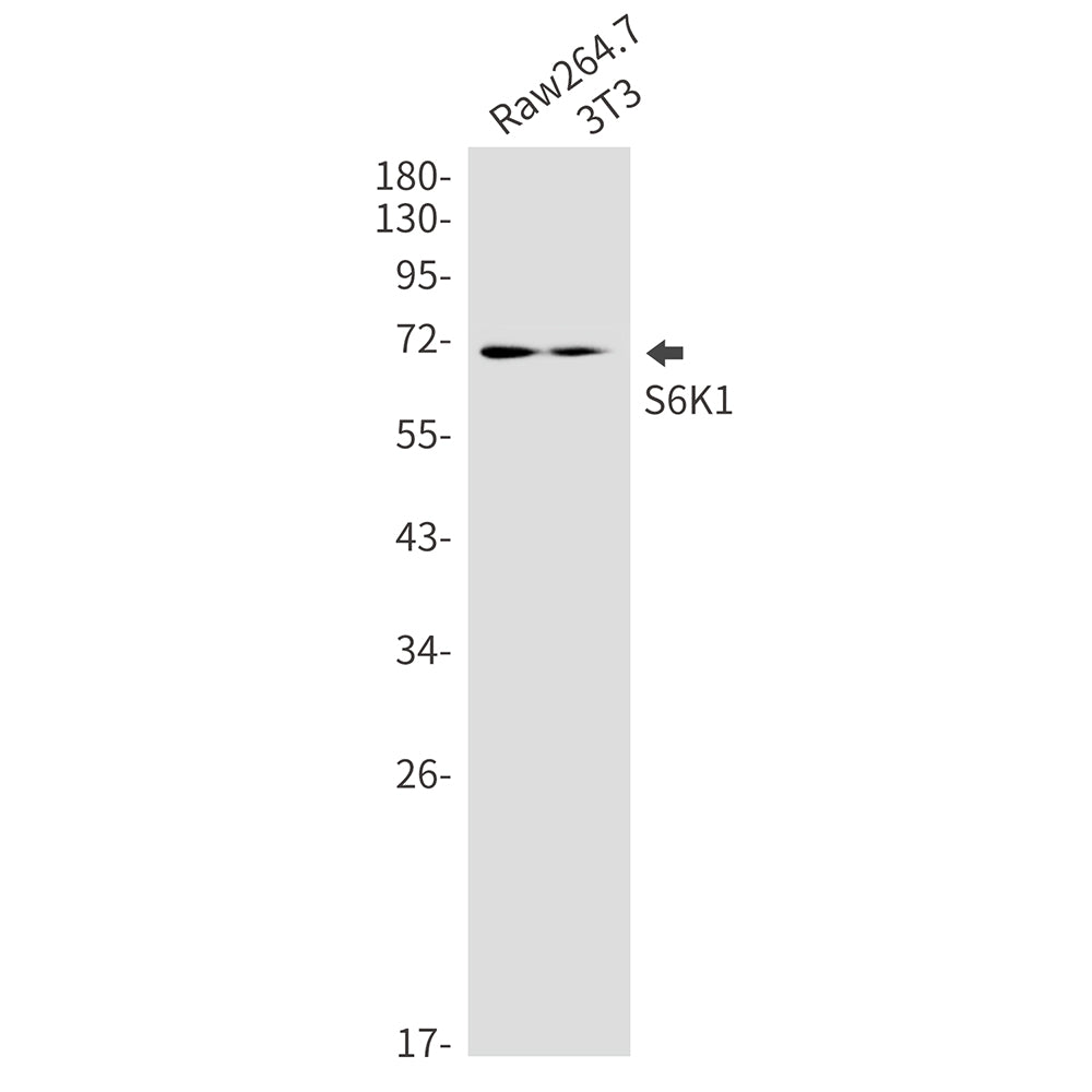Anti-S6K1 Rabbit Monoclonal Antibody