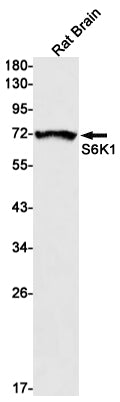 Anti-S6K1 Rabbit Monoclonal Antibody