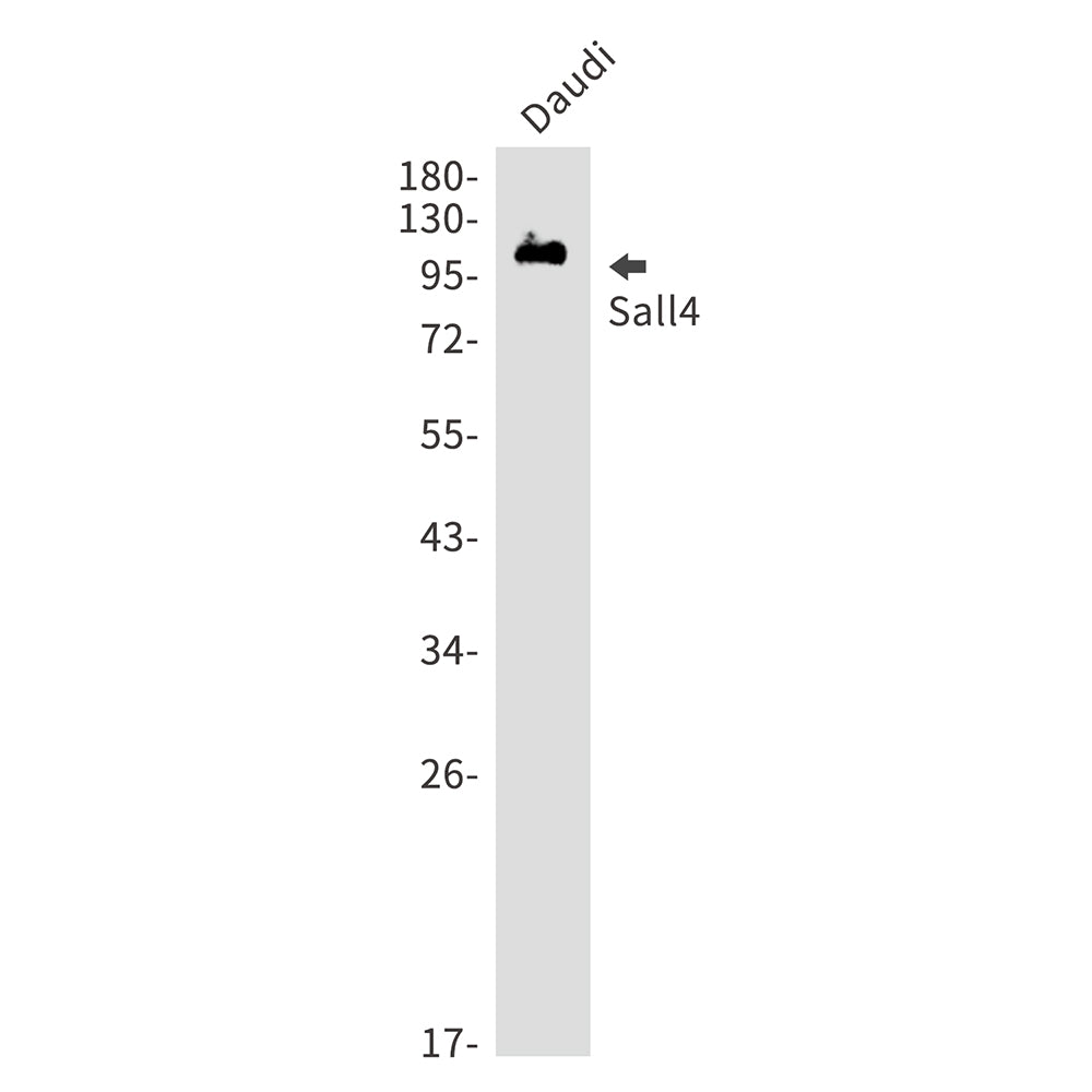 Anti-Sall4 Rabbit Monoclonal Antibody