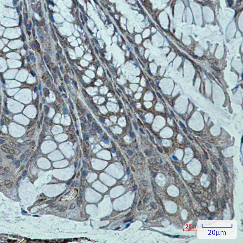 Anti-Sarcomeric alpha Actinin Rabbit Monoclonal Antibody