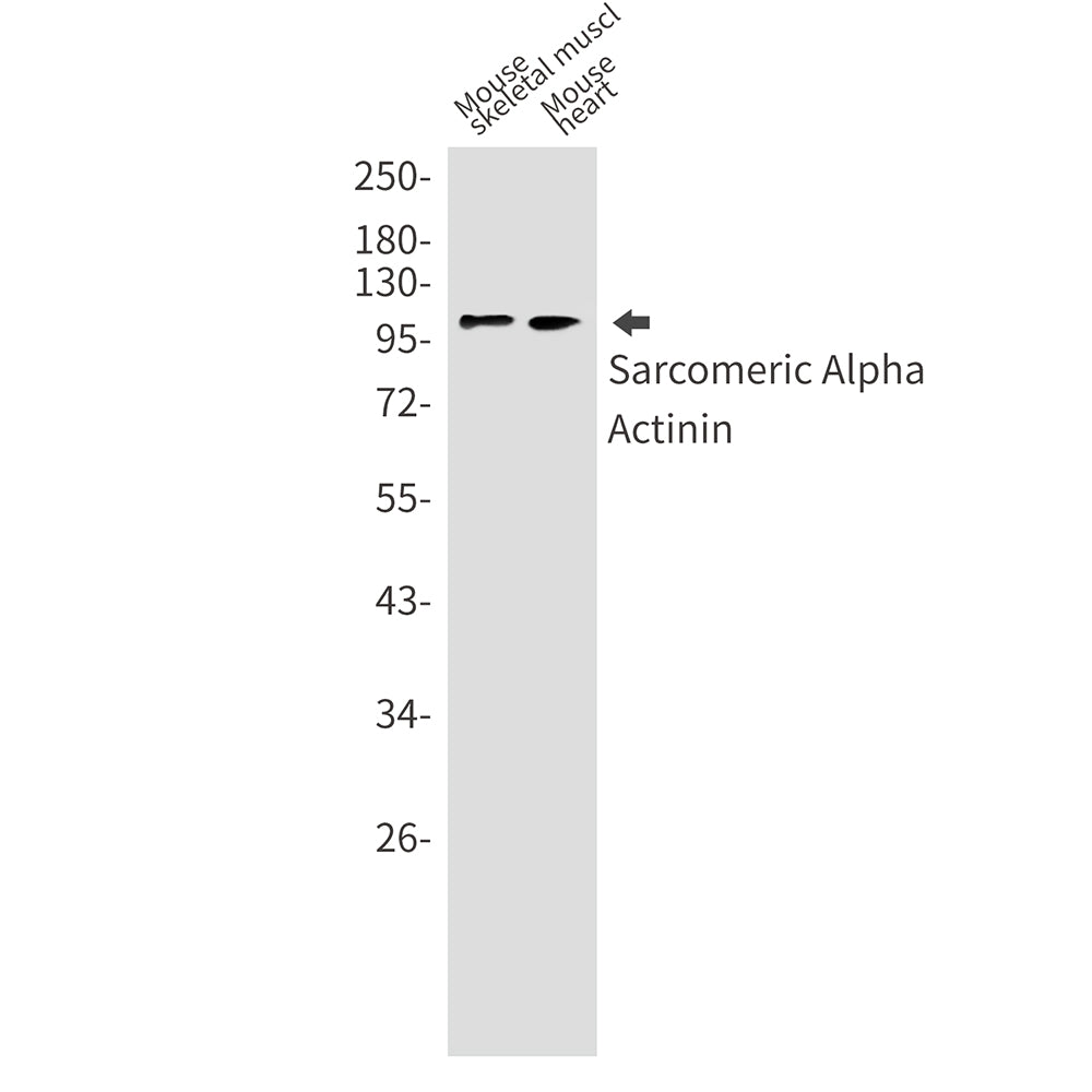 Anti-Sarcomeric alpha Actinin Rabbit Monoclonal Antibody