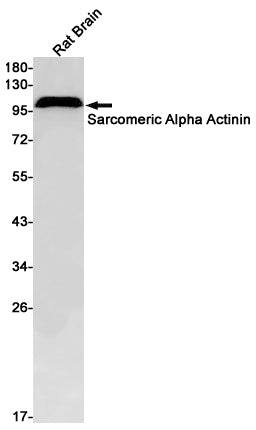 Anti-Sarcomeric alpha Actinin Rabbit Monoclonal Antibody