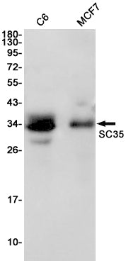 Anti-SC35 Rabbit Monoclonal Antibody