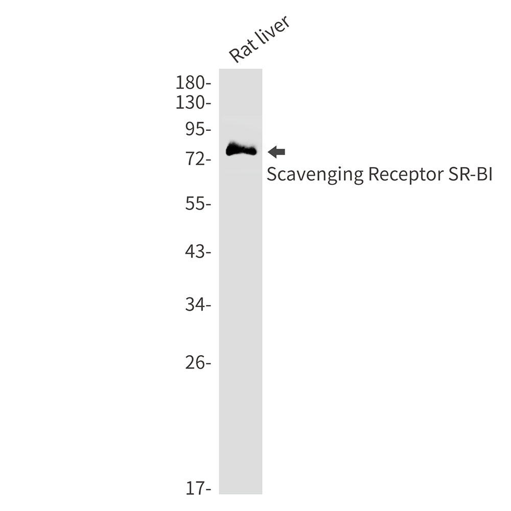 Anti-SCARB1 Rabbit Monoclonal Antibody