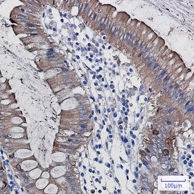 Anti-SCIN Rabbit Monoclonal Antibody