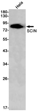 Anti-SCIN Rabbit Monoclonal Antibody