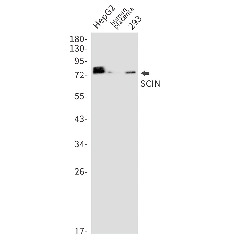 Anti-SCIN Rabbit Monoclonal Antibody