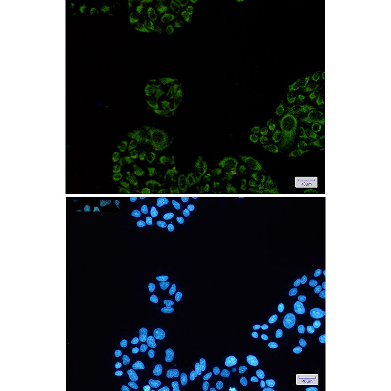 Anti-SDHA Rabbit Monoclonal Antibody